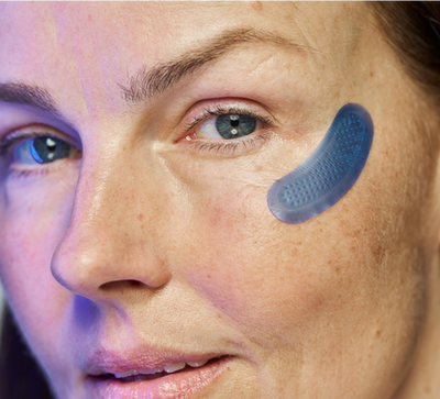 Micro-Infusion Patches