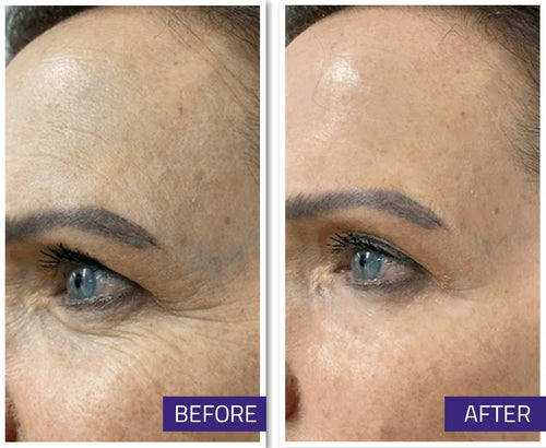 Korean 3D Lifting Cream