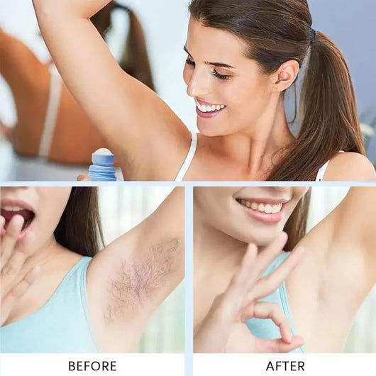 Triple Acid Smoothing Solution For Ingrown Hairs & Razor Bumps