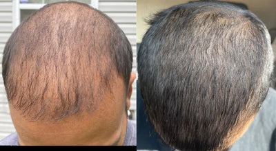 Regain - Hair Growth Serum