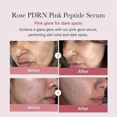 PDRN Salmon Serum
