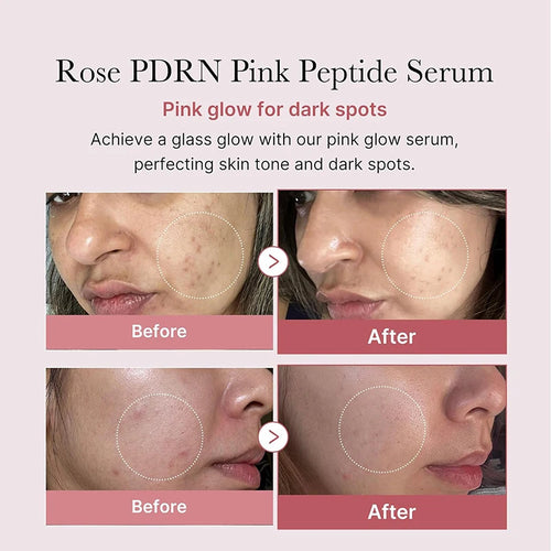 PDRN Salmon Serum