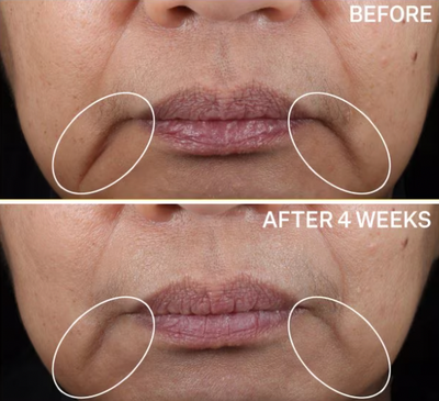 Korean 3D Lifting Cream