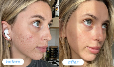 5 in 1 Multi Collagen Peptide Powder