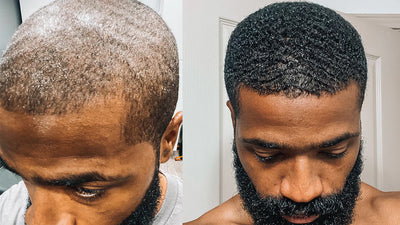 Regain - Hair Growth Serum