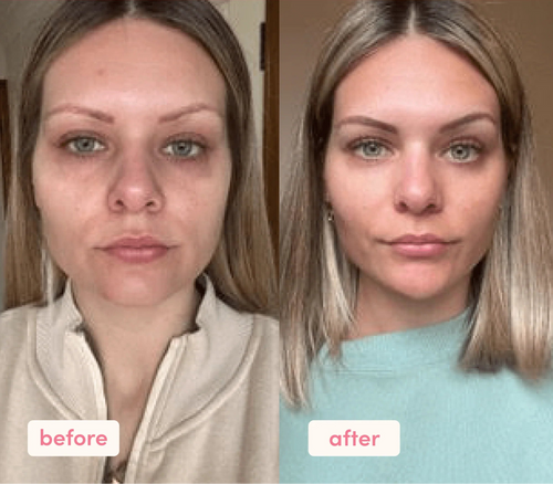 5 in 1 Multi Collagen Peptide Powder